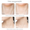 Rejuvenescedor Facial Iônico- Smart Pro